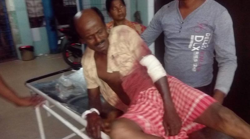 বন্ধুর বাড়িতে মদের আসরে গিয়ে গুলিবিদ্ধ ব্যক্তি, পুলিশের জালে অভিযুক্ত