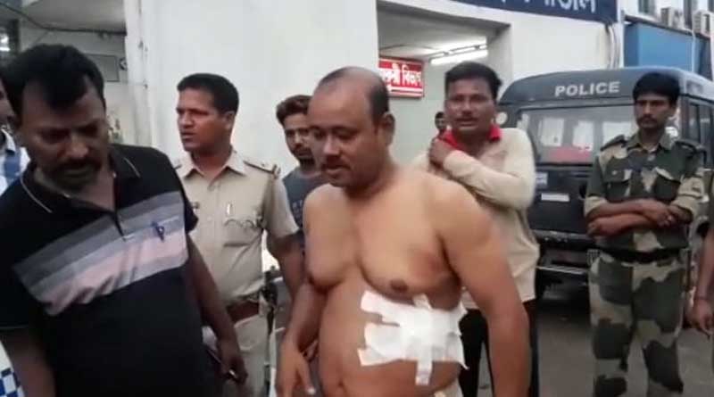 চোপড়ায় দুষ্কৃতীকে ধরতে গিয়ে আক্রান্ত পুলিশ, গুলিবিদ্ধ এসআই-সহ ৩