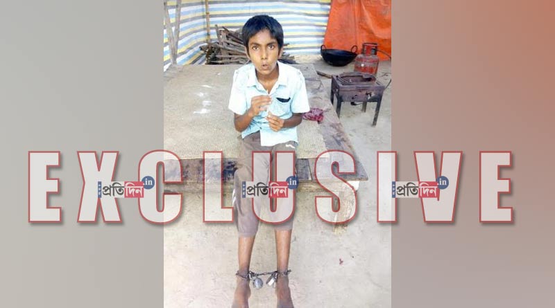 সুযোগ পেলেই পালানোর চেষ্টা, ছেলের পায়ে বেড়ি পড়ালেন বাবা-মা