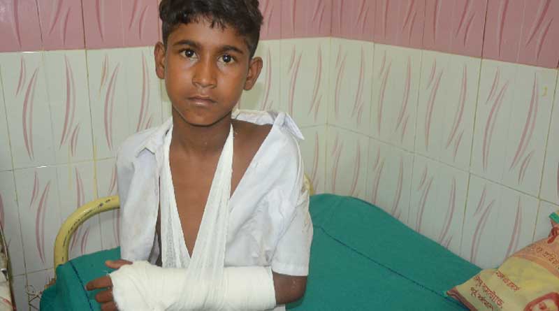 Student breaks his hand by fallin from wall in Ketugram