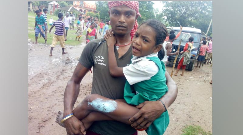 মেদিনীপুরে রাজনৈতিক হিংসা, তৃণমূল-বিজেপির সংঘর্ষে কোতয়ালিতে জখম শিশু-সহ ৩