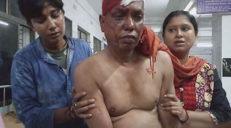 ভরা বাজারে তৃণমূল নেতার মাথায় হাতুড়ির ঘা, খুনের চেষ্টায় ধৃত অভিযুক্ত