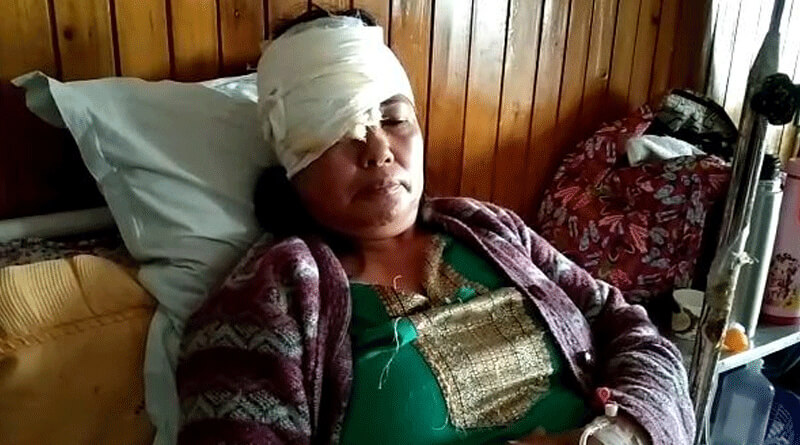 মালকিনকে বাঁচাতে চিতাবাঘের মুখোমুখি ‘টাইগার’, ল্যাজ গুটিয়ে পালাল ভয়ংকর প্রাণী