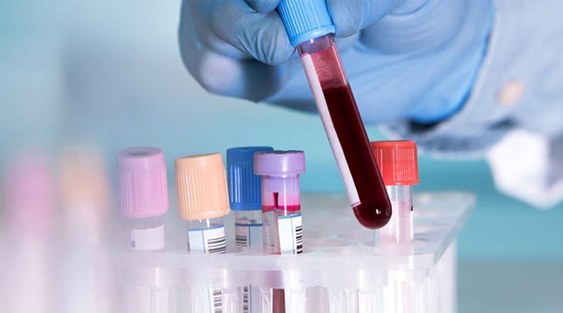 Blood test can predicts chances of dying in the next ten years