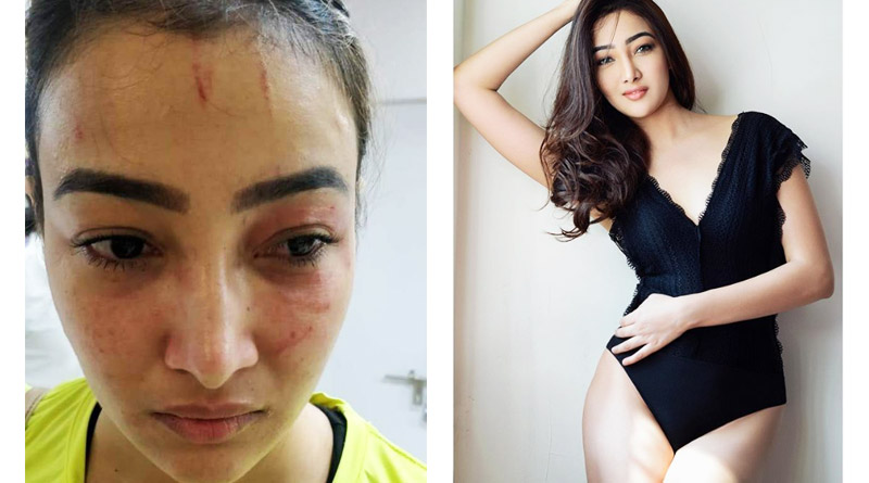 রুমমেটের বিরুদ্ধে মারধরের অভিযোগ, পুলিশের দারস্থ ছোটপর্দার নামী অভিনেত্রী