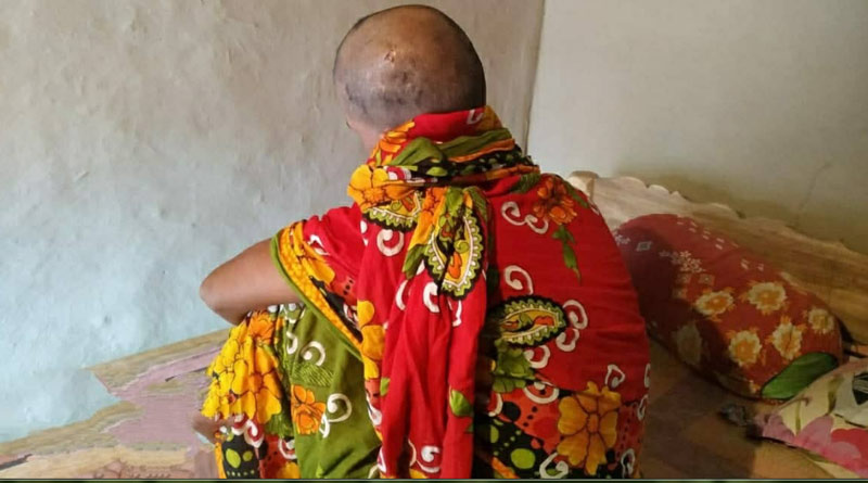 A woman tortured by husband and her hair ha sbeen cut