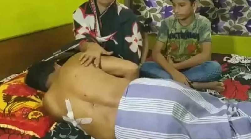 রাতদুপুরে গরু ব্যবসায়ীর উপর হামলা, পিঠে গুলি চালিয়ে চম্পট ৩ দুষ্কৃতীর