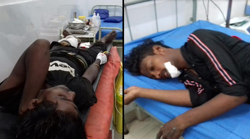 প্রশাসনের সচেতনতা প্রচারই সার, জোড়া পথ দুর্ঘটনায় মালবাজারে জখম চার