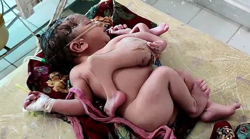 তিন হাত, চার পা! রাজস্থানে জন্ম নিল ‘ঈশ্বরের অবতার’