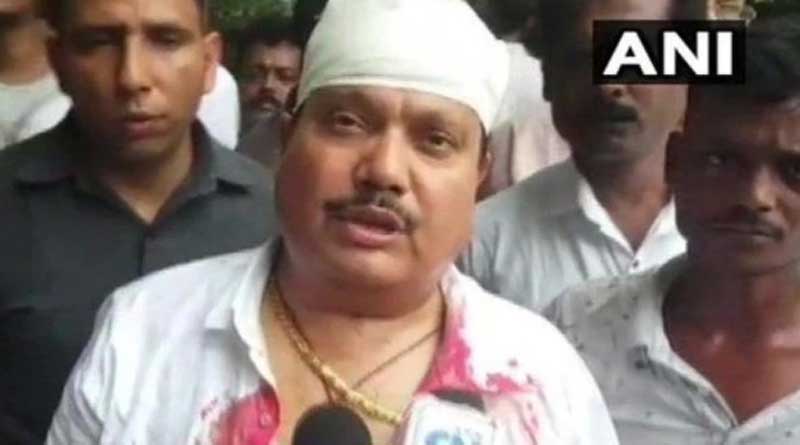 অশান্ত কাঁকিনাড়ায় মাথা ফাটল অর্জুন সিংয়ের, কাঠগড়ায় পুলিশ কমিশনার
