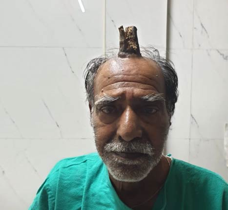man-with-horn
