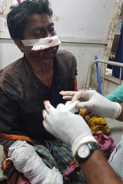 MSD-bombing-injured