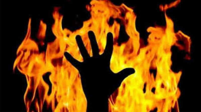 Wife and her lover set on fire man at Maldah, hospitalized