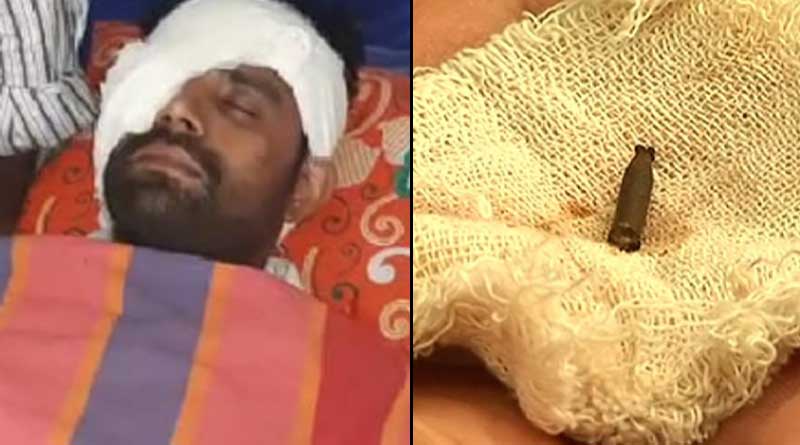 অস্ত্রোপচারেও চোখে থেকে গেল পেরেক, সরকারি হাসপাতালের গাফিলতিতে দৃষ্টি হারালেন যুবক