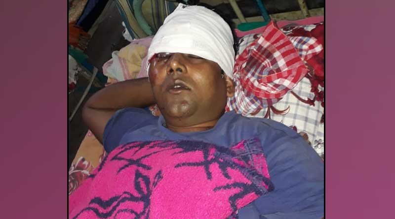 তৃণমূল কর্মীকে গুলি করে খুনের চেষ্টা, কাঠগড়ায় বিজেপি