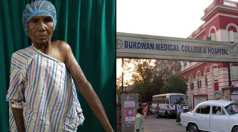 Burdwan Medical college makes history by off shoulder joint operation