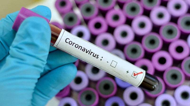 A man suspected corona virus infected, admitted on Burdwan medical