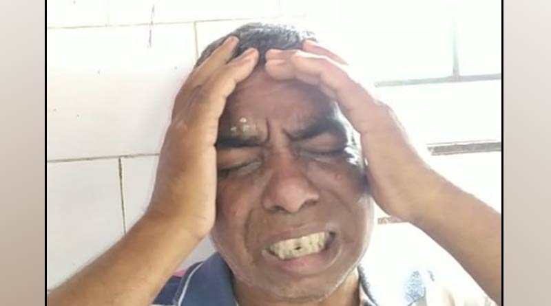 পারিবারিক অশান্তির জেরে স্বামীর চোখে খুন্তির ছ্যাঁকা মহিলার