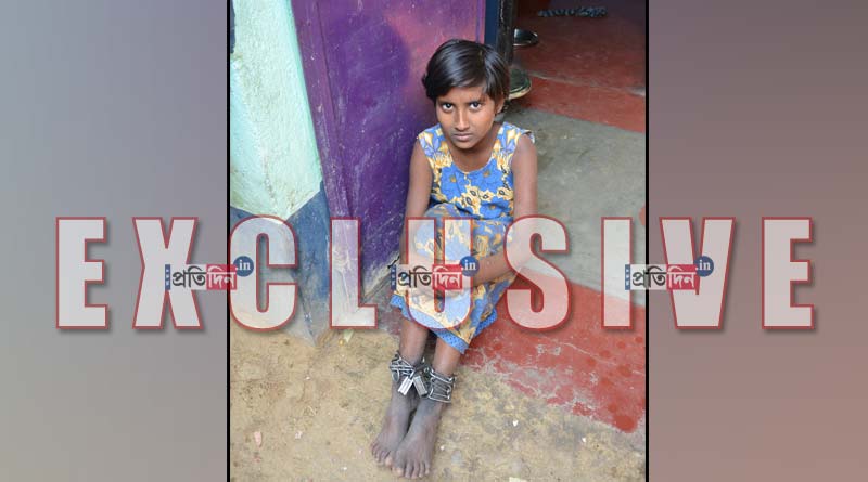 মানসিক অসুস্থ মেয়ে, দু’বছর ধরে কিশোরীর পায়ে শিকল পরিয়ে রেখেছে বাবা-মা