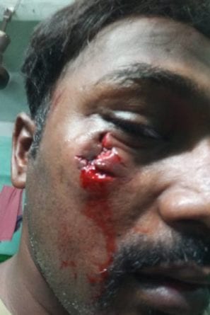 Baji-injured