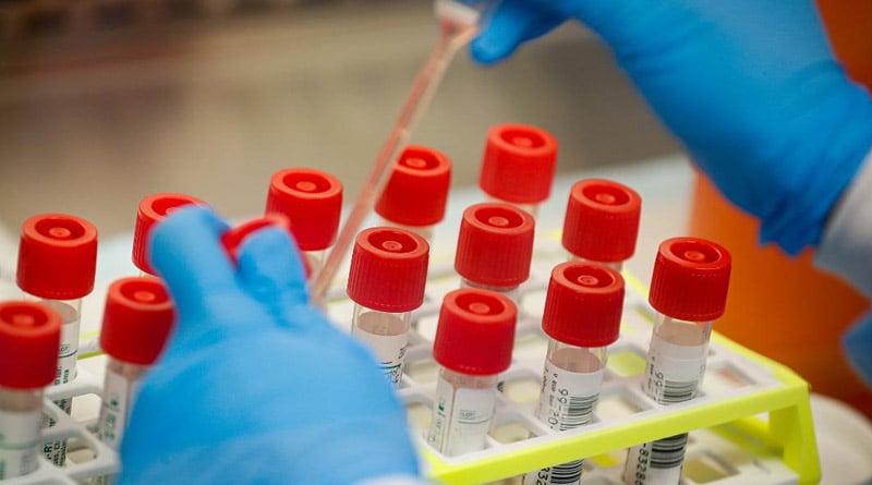 Maharashtra lab technician takes vaginal swab for coronavirus test