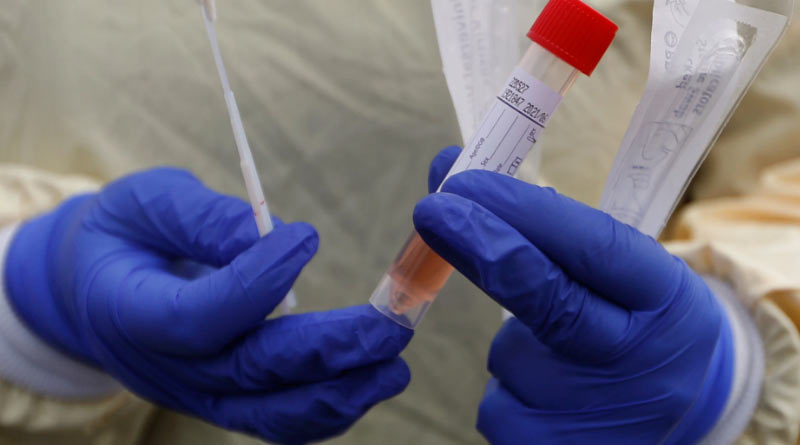 Blood test to detect coronavirus in 20 minutes developed: study