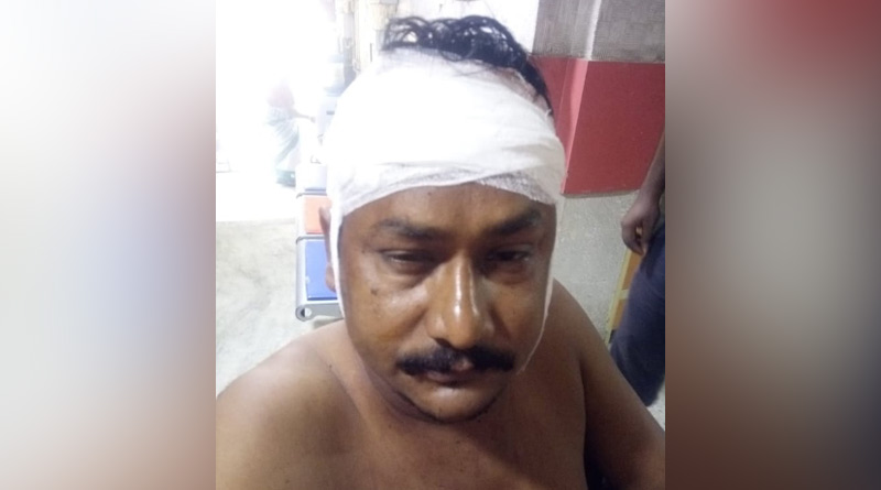 পূজালি পুরসভার তৃণমূল কাউন্সিলরকে ধারালো অস্ত্রের কোপ, আটক ২