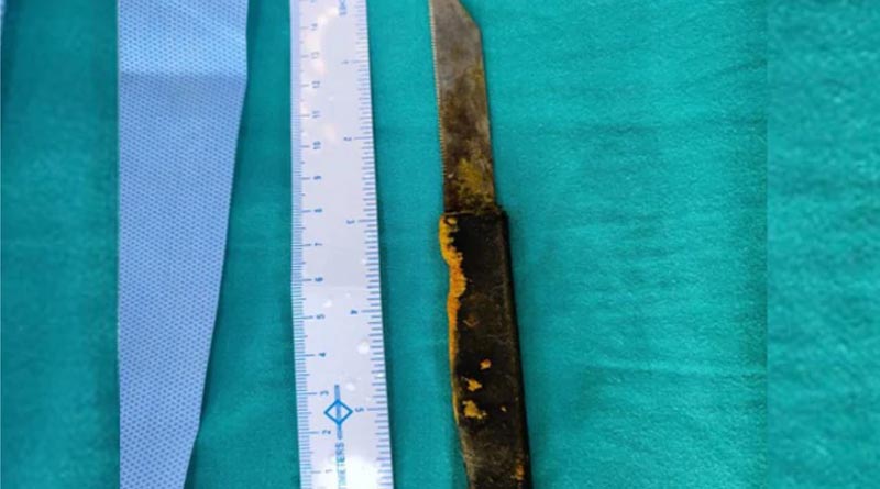 Man ate 20 cm knife, AIIMS doctors remove it in rare liver surgery