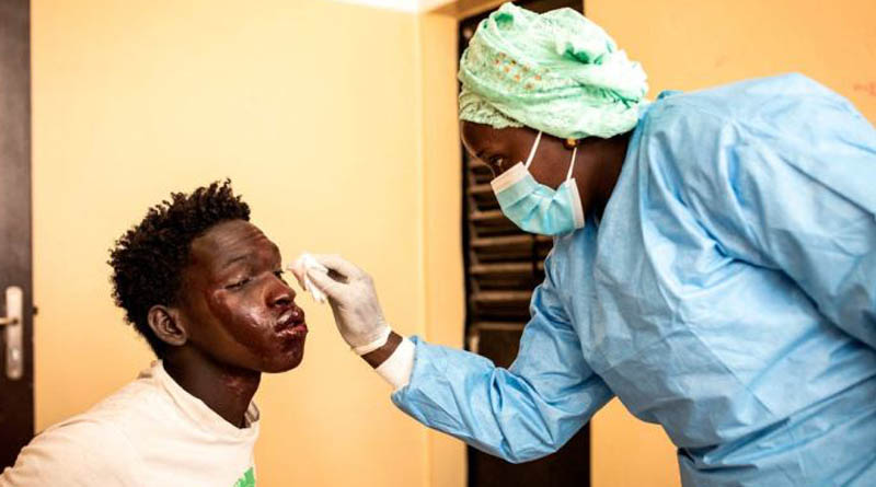 Hundreds of fishermen contract mysterious skin disease in Senegal | Sangbad Pratidin