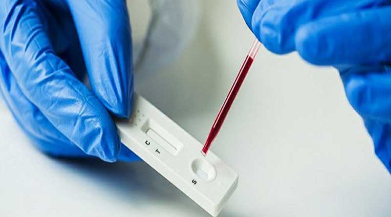 Cipla launches rapid antigen test kits for detecting Covid-19 | Sangbad Pratidin