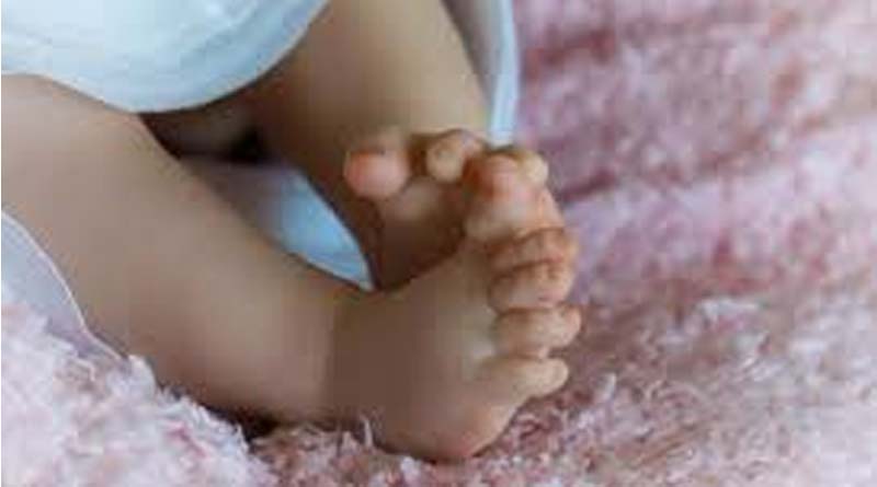 In Jharkhand, 8 fetuses found in new born baby's abdomen | Sangbad Pratidin