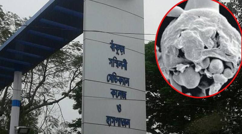 বাঁকুড়ায় ব্ল্যাক ফাঙ্গাসের থাবা, আক্রান্ত হয়ে হাসপাতালে চিকিৎসাধীন ৩ করোনা রোগী