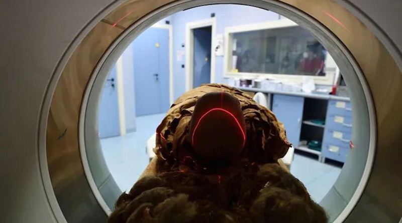 Italian hospital unveil secrets of Egyptian mummy using CT scan | Sangbad Pratidin