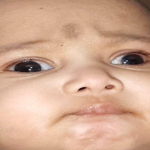 2 month old child receives vision after rare surgery at Apollo