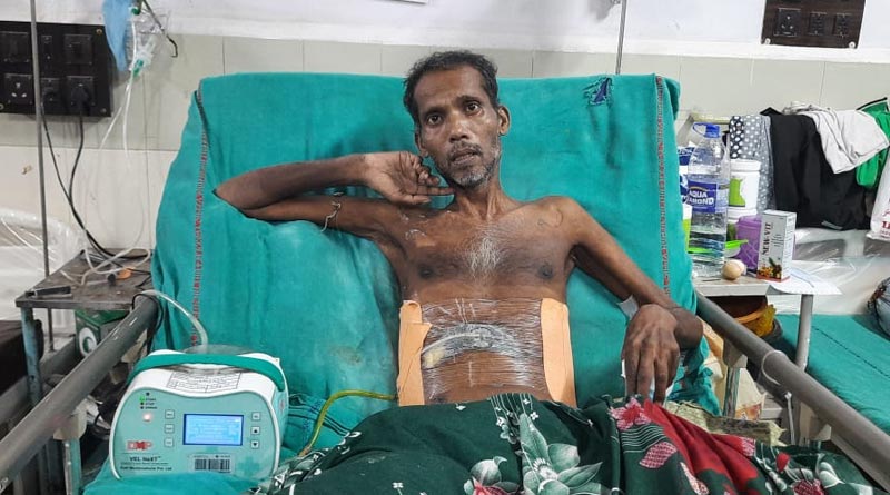 নয়া পদ্ধতিতে হরমোন বেরনোর গ্রন্থি থেকে টিউমার সরিয়ে নজির কলকাতার হাসপাতালের