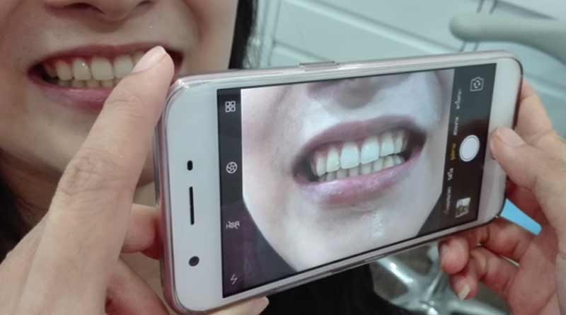 Indian Researchers Have Figured Out a Way to Authenticate Mobiles With Teeth | Sangbad Pratidin
