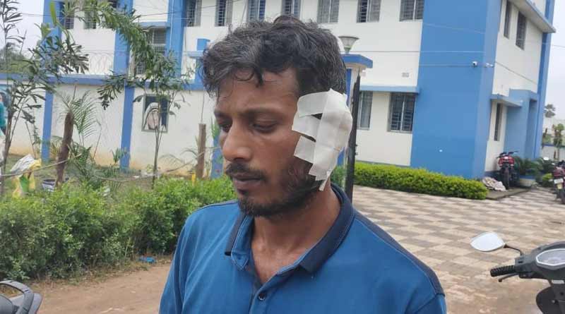 কান কামড়ে ছিঁড়ে নিল ‘রাক্ষস’ ছেলে! প্রতিবেশী যুবকের বিরুদ্ধে থানায় পুরকর্মী