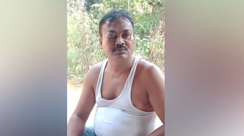 Tripura Municipal Election: ত্রিপুরায় বুথে-বুথে ‘আক্রান্ত’ তৃণমূল প্রার্থী-এজেন্ট, ‘নীরব দর্শক’ পুলিশ