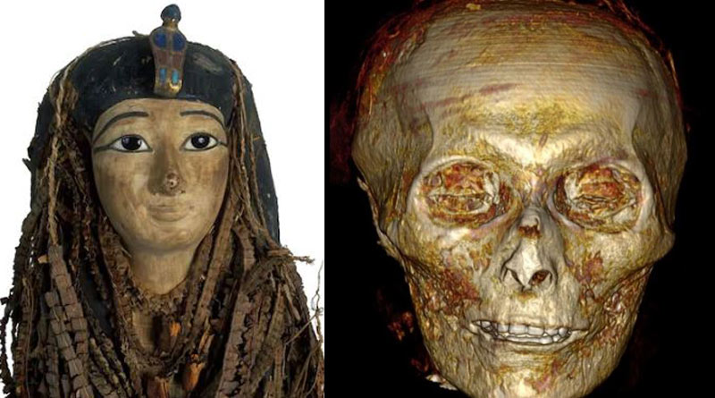 Scientists unwrap Egyptian mummy to find 3500-year-old king still has good teeth। Sangbad Pratidin