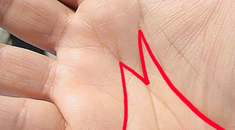Is there 'M' letter hidden into your palm? Know the future analysed by astrologers | Sangbad Pratidin
