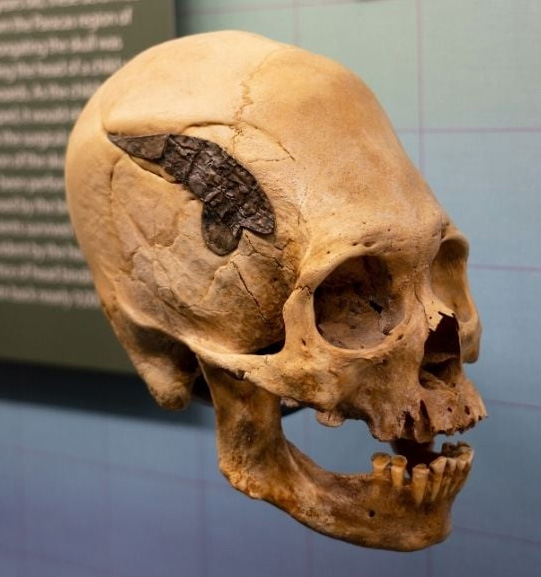 2,000 year old skull