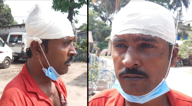 Son allegedly bitten father in Bongaon | Sangbad Pratidin