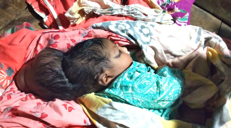শরীর এক, মাথা দুই, মুর্শিদাবাদে অদ্ভূতদর্শন শিশুকে ঘিরে চাঞ্চল্য