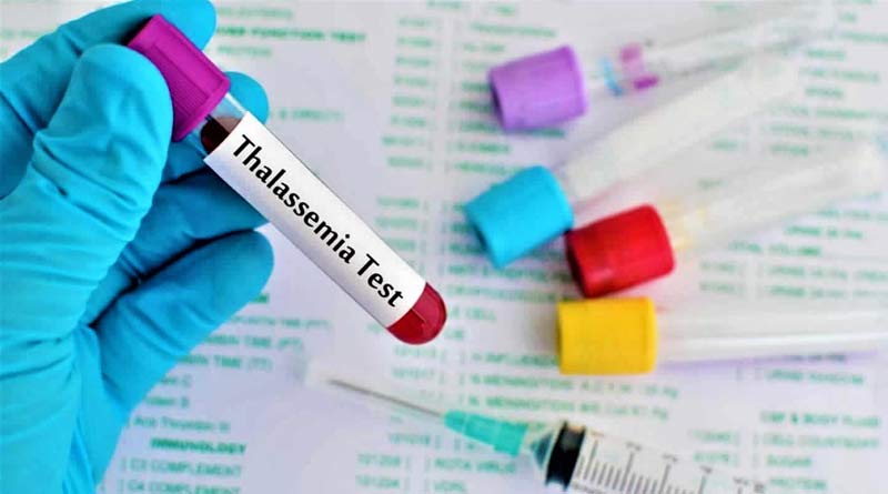 North Bengal has more carriers of Thalassemia, Experts concerned | Sangbad Pratidin