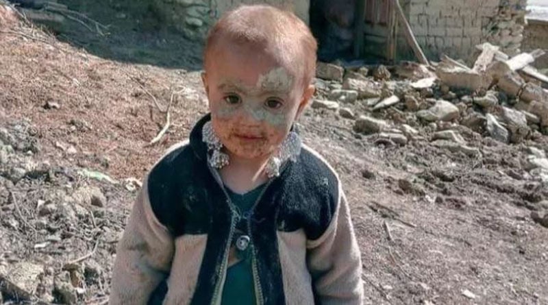 Photo of a little survivor of Afghanistan earthquake goes viral। Sangbad Pratidin