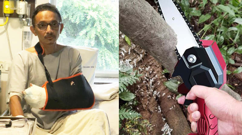 Kolkata hospital performs critical surgery, gives man hand back | Sangbad Pratidin