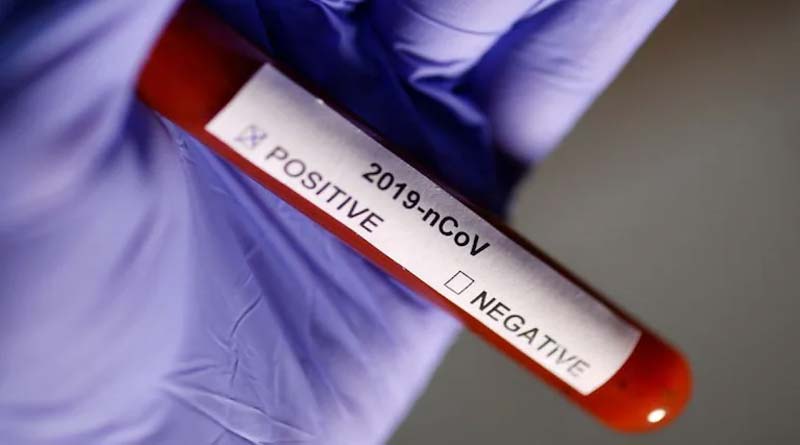 India reports 2,529 fresh coronavirus cases in the last 24 hours | Sangbad Pratidin
