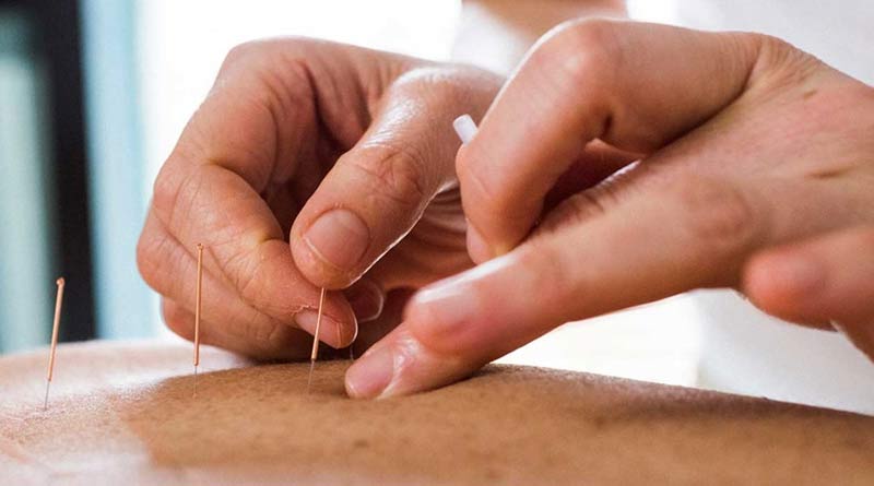 Degree course in Acupuncture treatment will be started in Kolkata | Sangbad Pratidin