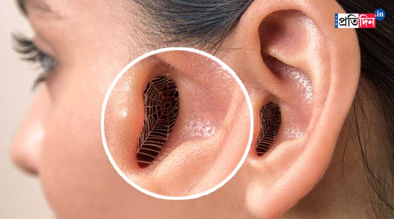 Chinese Woman Suffering From Ear Pain Finds Spider Nest Inside | Sangbad Pratidin