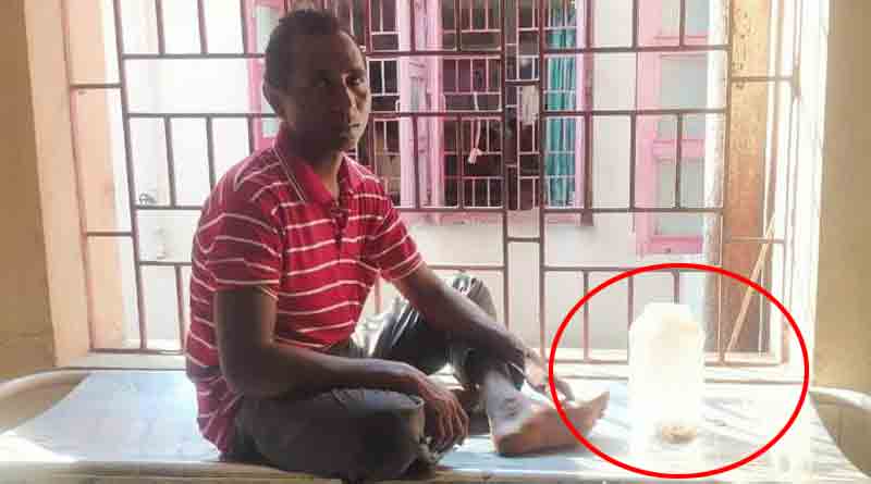 After being bitten Youth came to hospital with snake in Purulia | Sangbad Pratidin